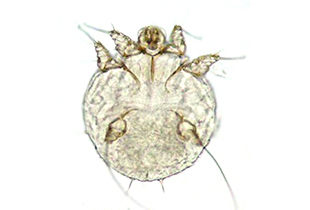 Sarcoptes Scabiei